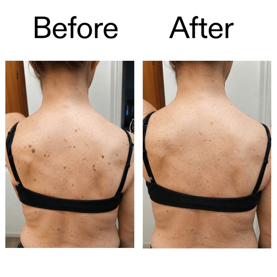 Smooth & Even Glycolic Body Stick - Equalize Labs