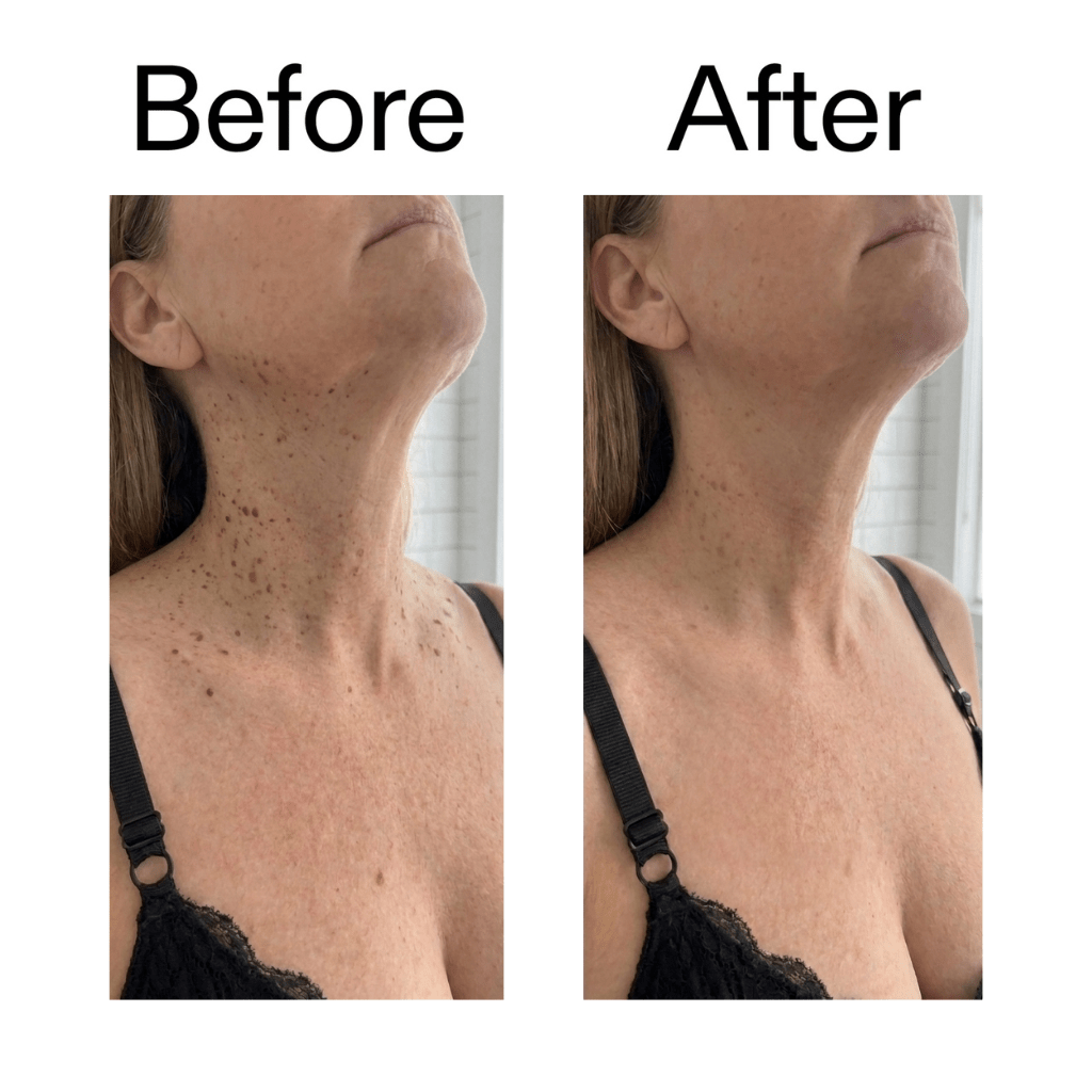Smooth & Even Glycolic Body Stick - Equalize Labs
