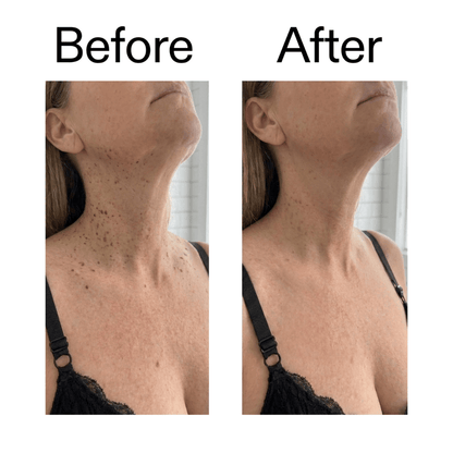 Smooth & Even Glycolic Body Stick - Equalize Labs